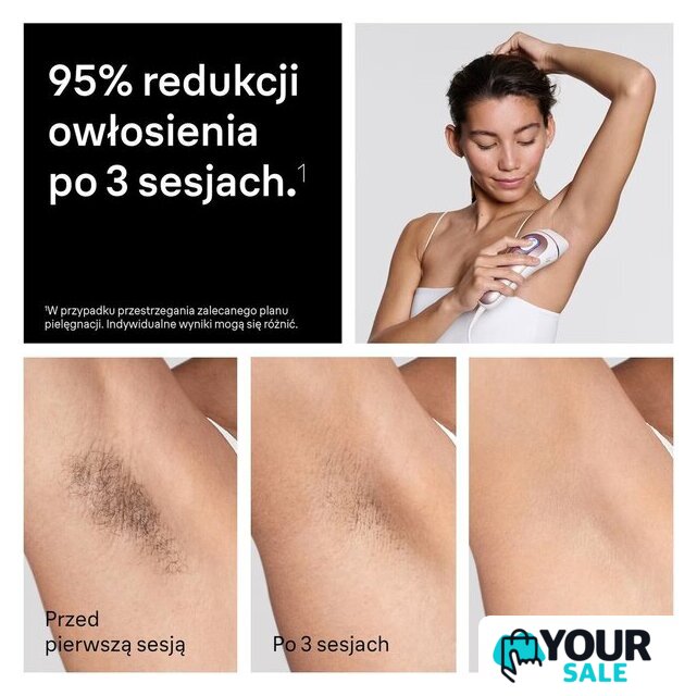 Фотоэпилятор Braun Skin i-expert Pro IPL PL7432 - Изображение №9 — Интернет-магазин Your Sale