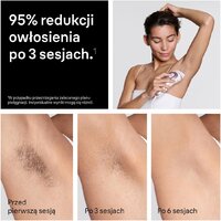 Фотоэпилятор Braun Skin i-expert Pro IPL PL7432 - Превью изображения №9 — Интернет-магазин Your Sale