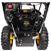 Снегоуборщик Champion ST662E - Превью изображения №5 — Интернет-магазин Your Sale